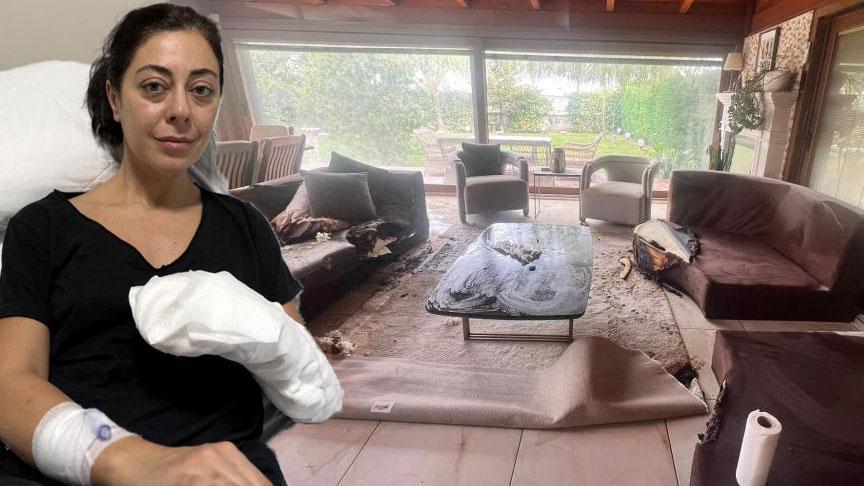 Dekoratif şömine bomba gibi patladı! Ölümden döndü: ‘Alev alev yanıyordum’