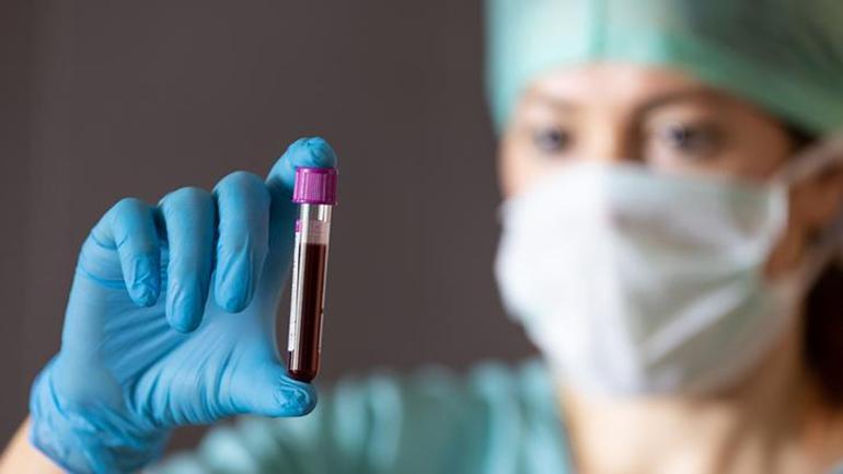 Dünyada sadece 50 kişide var! 'Altın kan' laboratuvarda üretilebilecek mi?