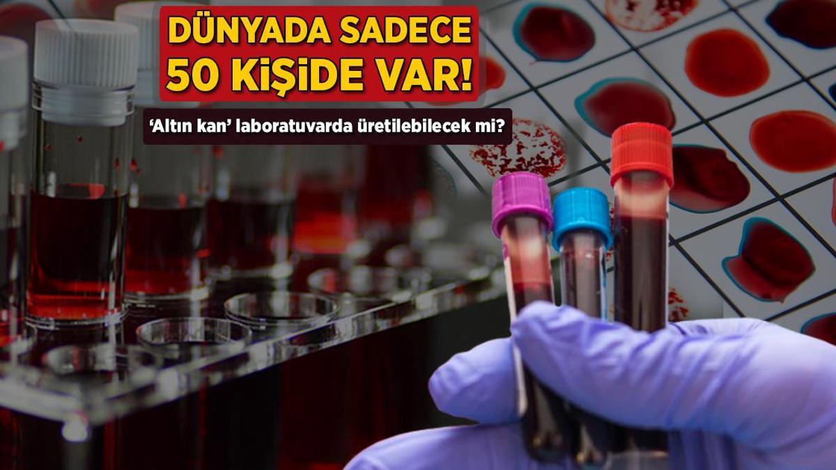 Dünyada sadece 50 kişide var! ‘Altın kan’ laboratuvarda üretilebilecek mi?