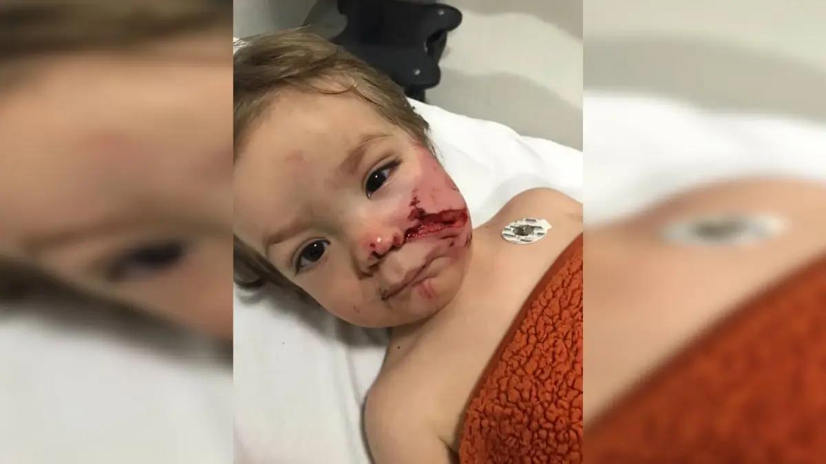 Pitbull Köpeği Taarruzunda 2 Çocuk Yaralandı