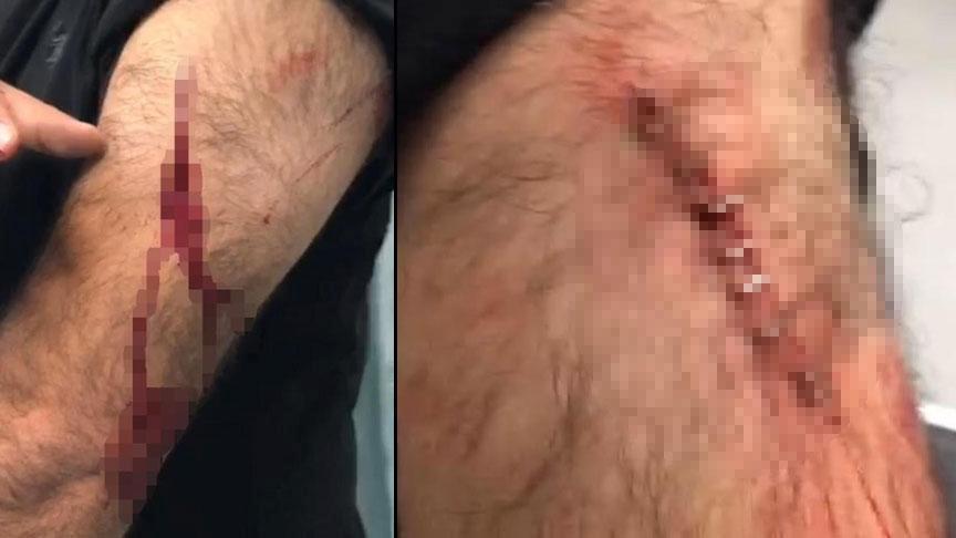 Şanlıurfa’da dehşet! Öğretmene sokakta jiletli saldırı